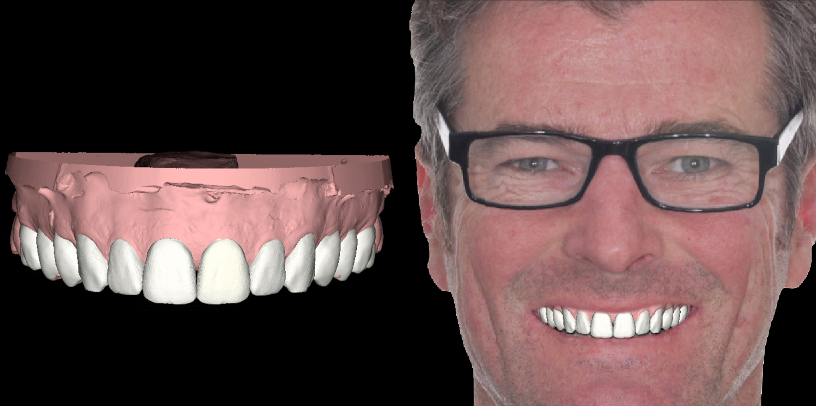 Digital Smile Design: Transforming Dentistry | Verve Magazine