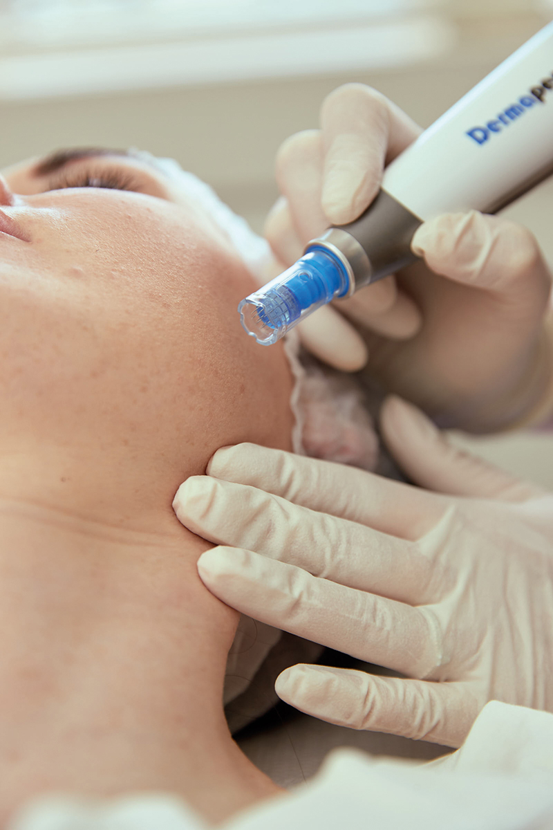 clinic 42 skin needling